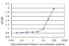 Anti-AGTRAP Polyclonal Antibody Pair