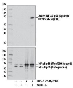 Anti-NFkB p65, acetaldehyde Rabbit Monoclonal Antibody [clone: 13G54]