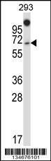 Anti-NUMBL Rabbit Polyclonal Antibody (AP (Alkaline Phosphatase))