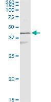 Anti-KRT17 Mouse Monoclonal Antibody [clone: 2D4-1G9]