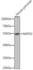 Anti-NDP52 Antibody (A10128)