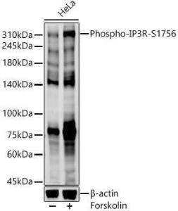 Western blot analysis of various lysates, using Anti-IP3 receptor (phospho Ser1756) Antibody (A308437) at 1:400 dilution HeLa cells were treated by Forskolin (10 uM) at 37°C for 1 hour after serum-starvation overnight