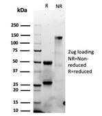 SDS-PAGE analysis of Anti-Granzyme B Antibody [GZMB/6530R] under non-reduced and reduced conditions; showing intact IgG and intact heavy and light chains, respectively. SDS-PAGE analysis confirms the integrity and purity of the antibody.