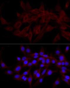 Immunofluorescence analysis of PC-12 cells using Anti-NDP52 Antibody (A10128) at a dilution of 1:200 (40X lens). DAPI was used to stain the cell nuclei (blue)