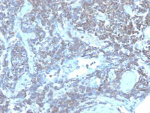 Immunohistochemical analysis of formalin-fixed, paraffin-embedded human lymph node tissue using Anti-CD48 Antibody [CD48/4784]