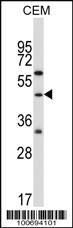 Anti-CBLC Rabbit Polyclonal Antibody