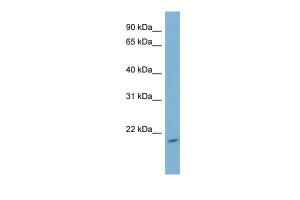 Anti-NME4 Rabbit Polyclonal Antibody