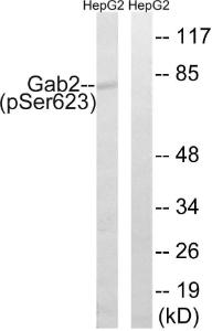 Western blot analysis of lysates from HepG2 cells treated with PMA 125 ng/ml 30' using Anti-Gab2 (phospho Ser623) Antibody. The right hand lane represents a negative control, where the Antibody is blocked by the immunising peptide