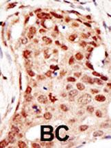 Anti-CBLC Rabbit Polyclonal Antibody