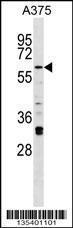 Anti-IRAK2 Rabbit Polyclonal Antibody (FITC (Fluorescein Isothiocyanate))