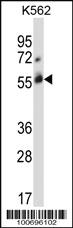 Anti-CBLC Rabbit Polyclonal Antibody