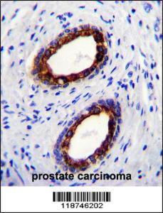 Anti-KRT18 Rabbit Polyclonal Antibody