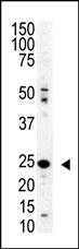 Anti-SENP8 Rabbit Polyclonal Antibody