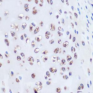 Immunohistochemistry analysis of paraffin-embedded rat bone marrow using Anti-Aggrecan Antibody [ARC0678] (A80867) at a dilution of 1:100 (40x lens). Perform microwave antigen retrieval with 10 mM PBS buffer pH 7.2 before commencing with IHC staining protocol.