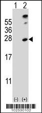 Anti-SENP8 Rabbit Polyclonal Antibody