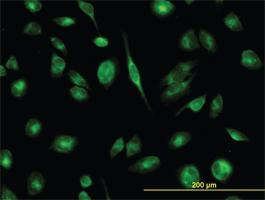 Anti-TCP1 Mouse Monoclonal Antibody [clone: 2B2-D6]