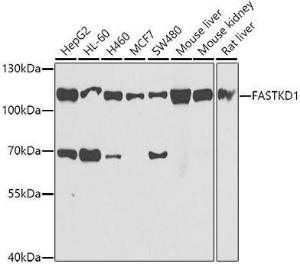 Antibody anti-FASTKD1 100 µl