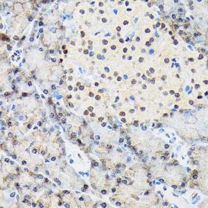 Anti-TRBP Rabbit Monoclonal Antibody [clone: ARC1792]