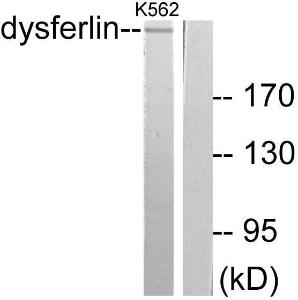 Anti-Dysferlin antibody