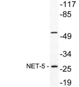 Western blot analysis of lysate from A549 cells using Anti-NET-5 Antibody