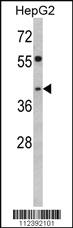 Anti-TOB2 Rabbit Polyclonal Antibody