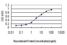 Anti-LLGL1 Mouse Monoclonal Antibody [clone: 5G2]