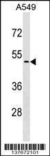 Anti-CDKL4 Rabbit Polyclonal Antibody (FITC (Fluorescein Isothiocyanate))