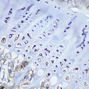 Immunohistochemistry analysis of paraffin-embedded mouse bone marrow using Anti-Aggrecan Antibody [ARC0678] (A80867) at a dilution of 1:100 (40x lens). Perform microwave antigen retrieval with 10 mM PBS buffer pH 7.2 before commencing with IHC staining protocol.