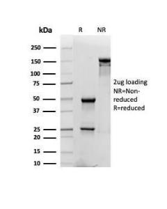 SDS-PAGE analysis of Anti-CD48 Antibody [CD48/4784] under non-reduced and reduced conditions; showing intact IgG and intact heavy and light chains, respectively. SDS-PAGE analysis confirms the integrity and purity of the antibody