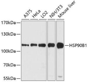 Western blot analysis of extracts of various cell lines, using Anti-GRP94 Antibody (A305806) at 1:1,000 dilution The secondary antibody was Goat Anti-Rabbit IgG H&L Antibody (HRP) at 1:10,000 dilution Lysates/proteins were present at 25 µg per lane