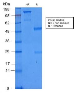 SDS-PAGE analysis of Anti-NULL Antibody [C86/2160R] under non-reduced and reduced conditions; showing intact IgG and intact heavy and light chains, respectively. SDS-PAGE analysis confirms the integrity and purity of the antibody.