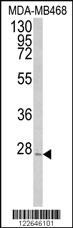 Anti-OSM Rabbit Polyclonal Antibody