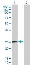 Anti-TAF10 Rabbit Polyclonal Antibody