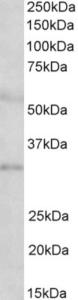 EB11949 (2 µg/ml) staining of Human Placenta lysate (35 µg protein in RIPA buffer). Primary incubation was 1 hour. Detected by chemiluminescence.