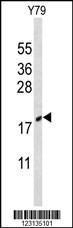 Anti-CIRBP Rabbit Polyclonal Antibody (PE (Phycoerythrin))