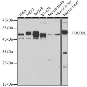 Anti-PDCD2L antibody