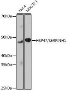 Western blot analysis of extracts of various cell lines, using Anti-Hsp47 Antibody [ARC0681] (A80870) at 1:1000 dilution. The secondary Antibody was Goat Anti-Rabbit IgG H&L Antibody (HRP) at 1:10000 dilution. Lysates/proteins were present at 25 µg per lane