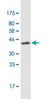 Anti-CACNA1F Mouse Monoclonal Antibody [clone: 3B2]