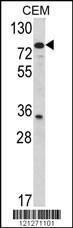 Anti-TGM4 Rabbit Polyclonal Antibody (HRP (Horseradish Peroxidase))