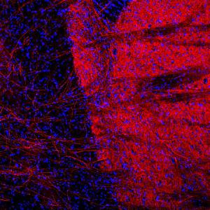 Antibody anti-tryosine hydroxylase 4H2