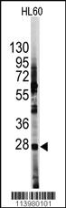 Anti-HES1 Rabbit Polyclonal Antibody