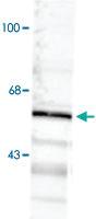 Anti-GABRA6 Rabbit Polyclonal Antibody