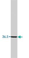 Anti-CACNG4 Rabbit Polyclonal Antibody