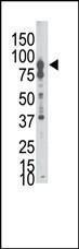 Anti-EPHB6 Rabbit Polyclonal Antibody (APC (Allophycocyanin))