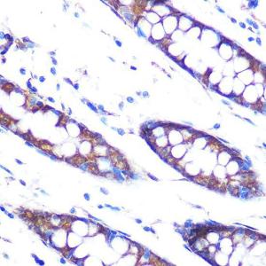 Immunohistochemistry analysis of paraffin-embedded human colon tissue using Anti-Hsp47 Antibody [ARC0681] (A80870) at a dilution of 1:100 (40X lens). Perform microwave antigen retrieval with 10 mM PBS buffer pH 7.2 before commencing with IHC staining protocol