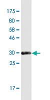 Anti-RNF170 Mouse Monoclonal Antibody [clone: 2D6]