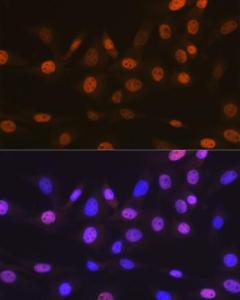 Anti-TRBP Rabbit Monoclonal Antibody [clone: ARC1792]