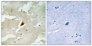 Immunohistochemical analysis of paraffin-embedded human brain tissue using Anti-MAPKAPK5 Antibody The right hand panel represents a negative control, where the antibody was pre-incubated with the immunising peptide