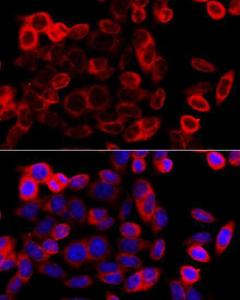 Immunofluorescence analysis of HeLa cells using Anti-GRP94 Antibody (A305806) at a dilution of 1:100 (40x lens) DAPI was used to stain the cell nuclei (blue)