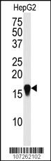 Anti-SUMO4 (M55 Wild type) Rabbit Polyclonal Antibody